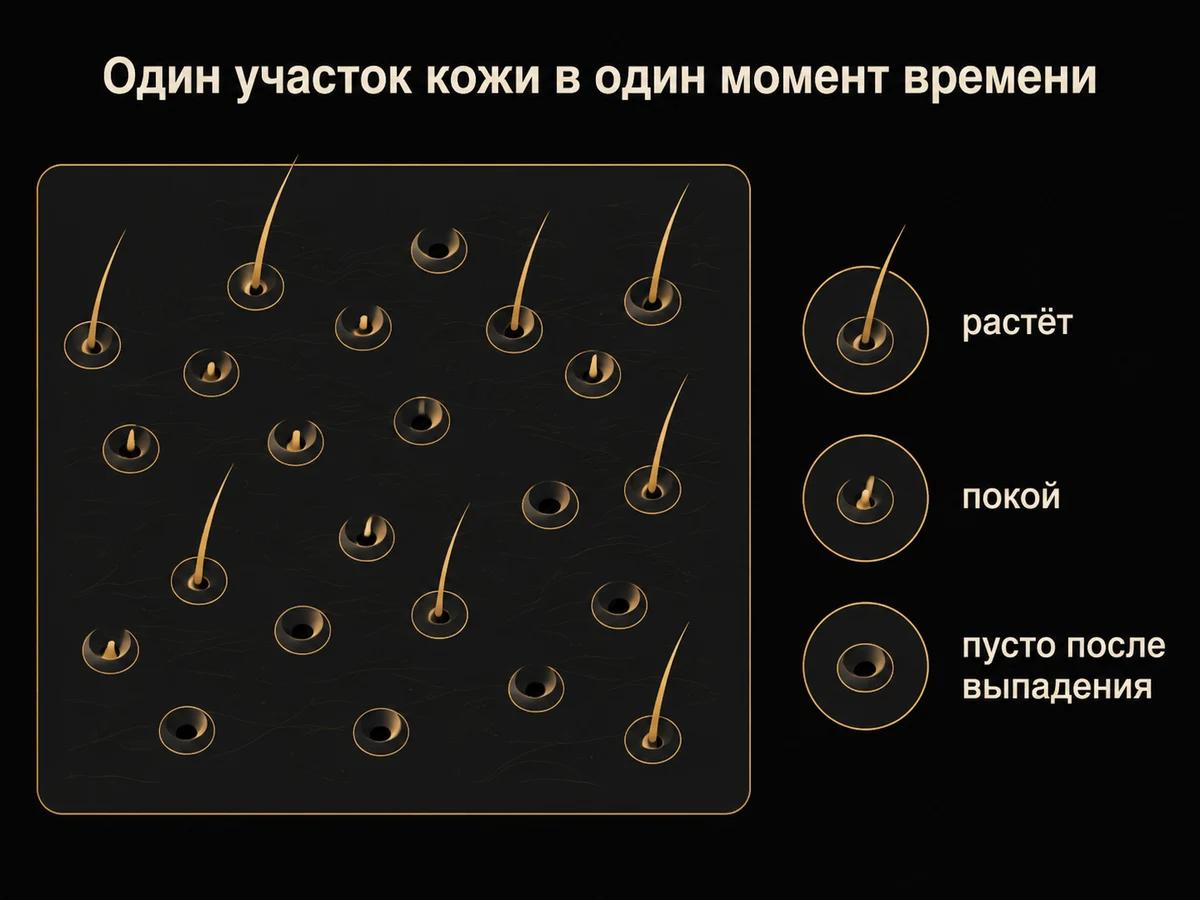 Схема участка кожи щеки: соседние фолликулы находятся в разных фазах цикла