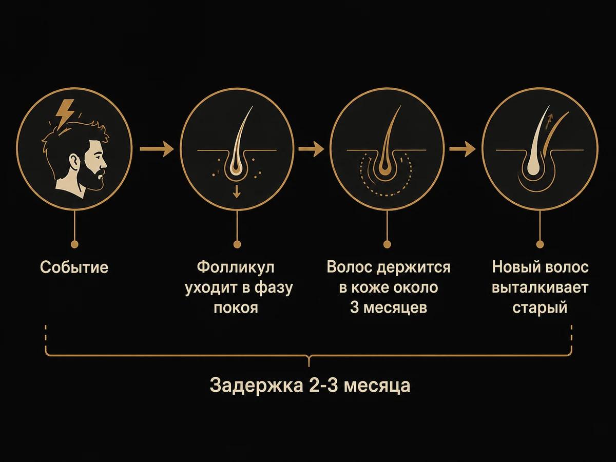 Схема задержки: событие переводит фолликул в фазу покоя, волос выпадает через три месяца
