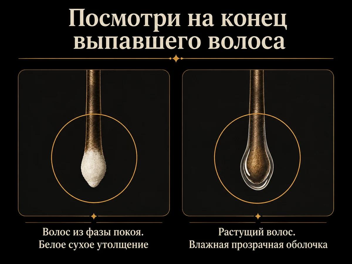 Схема: корень телогенового волоса с белым утолщением против корня растущего волоса с оболочкой
