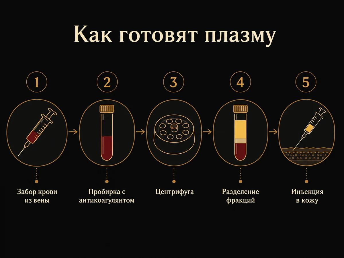 Схема из пяти шагов: забор крови, пробирка с антикоагулянтом, центрифуга, разделение фракций, инъекция в кожу