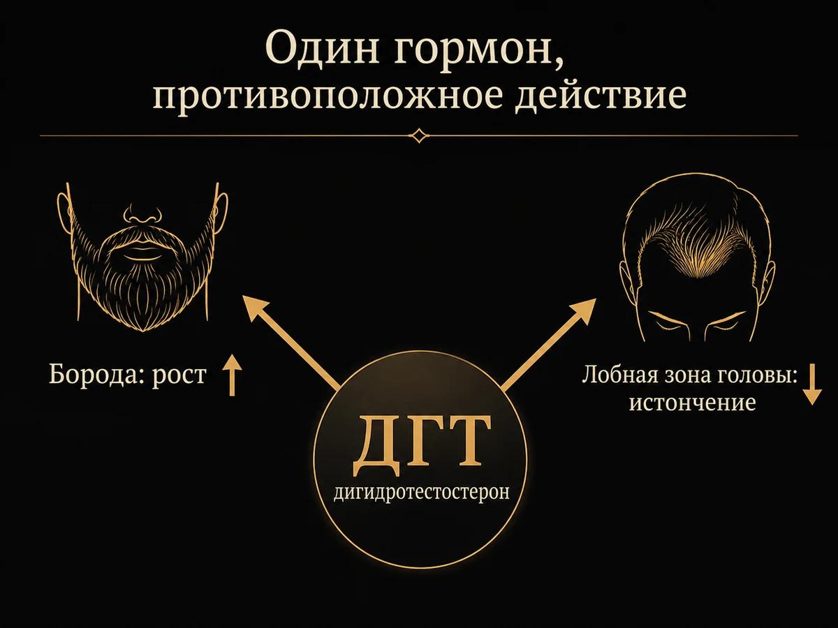 Схема андрогенного парадокса: дигидротестостерон одновременно стимулирует рост бороды и вызывает истончение волос в лобной зоне головы